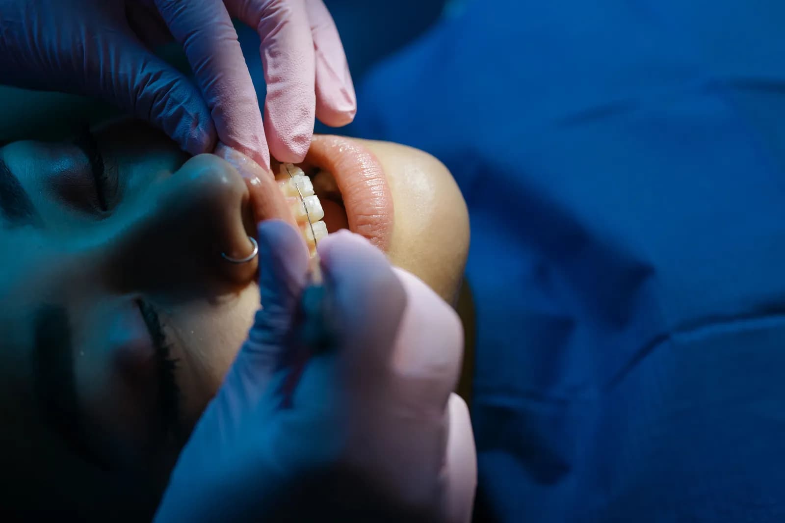 Orthodontiste examinant un patient
